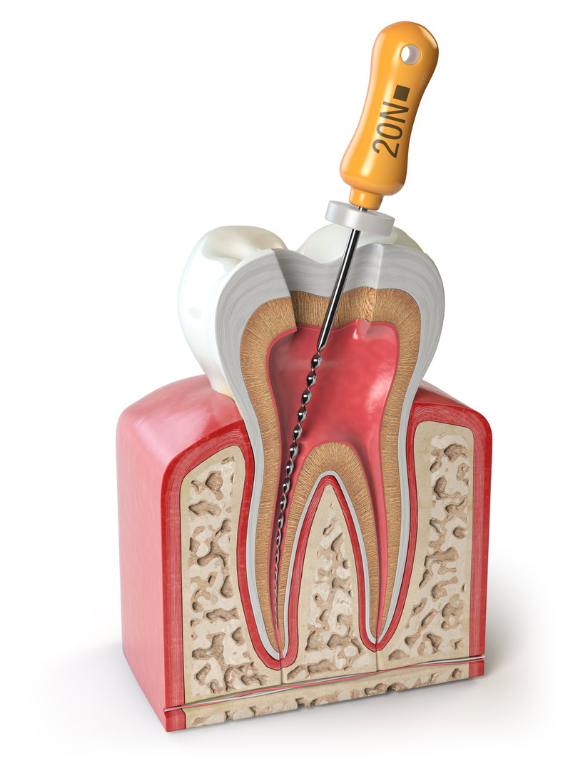 endodontist3